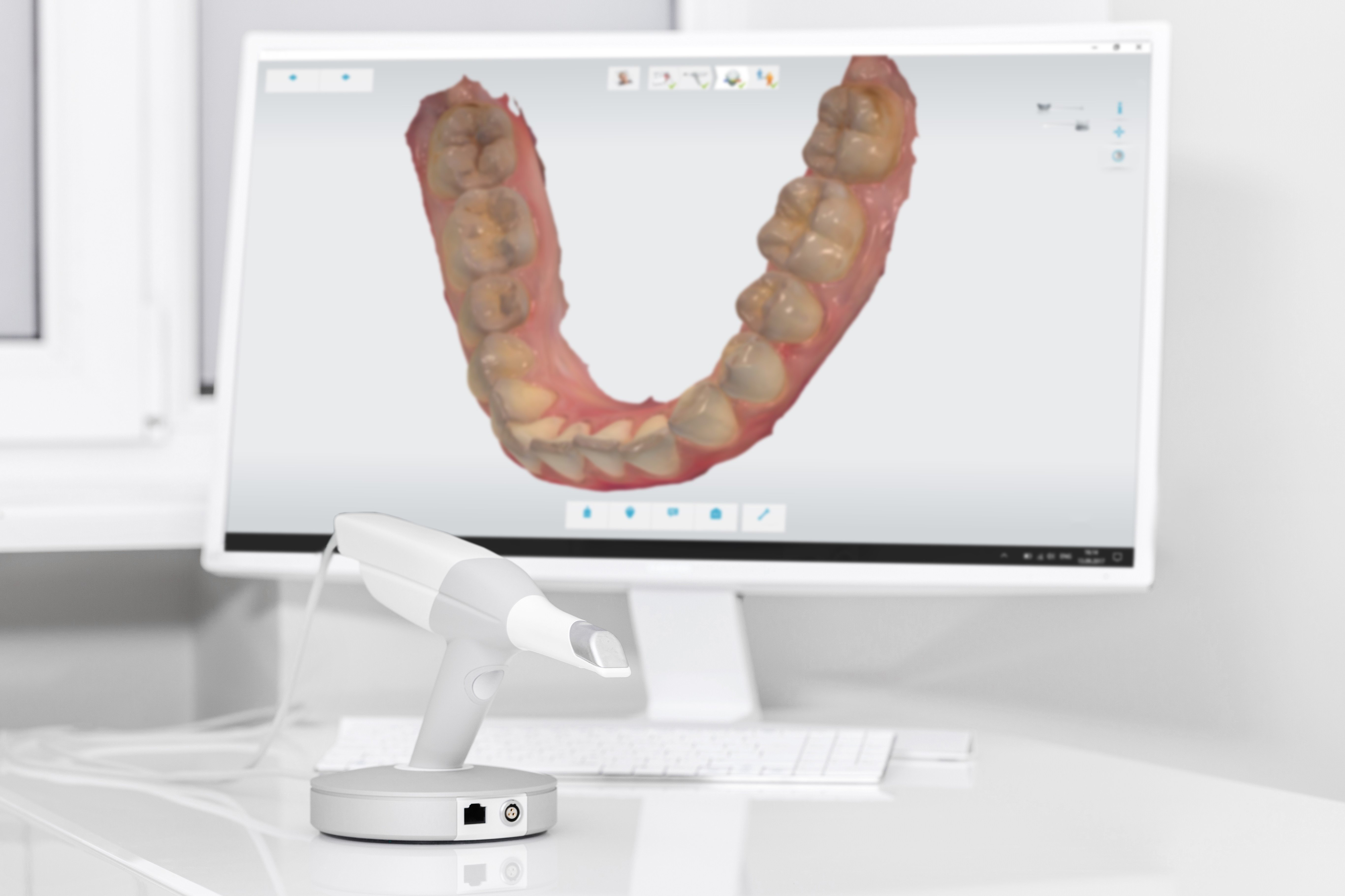 Dental scanner